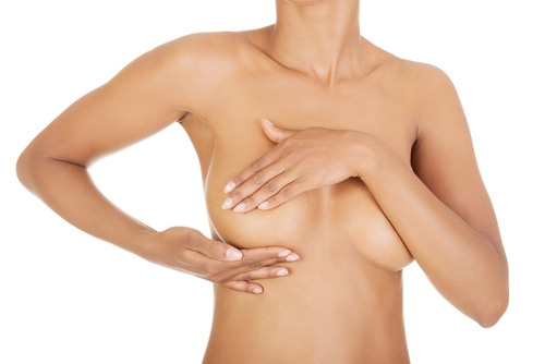 Bruststraffung mit Brustverkleinerung